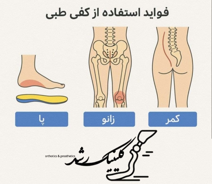 تأثیر کفی طبی در کاهش درد پا، زانو و کمر