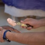 مراحل ساخت پروتز انگشت دست در ارتوپد فنی رشد