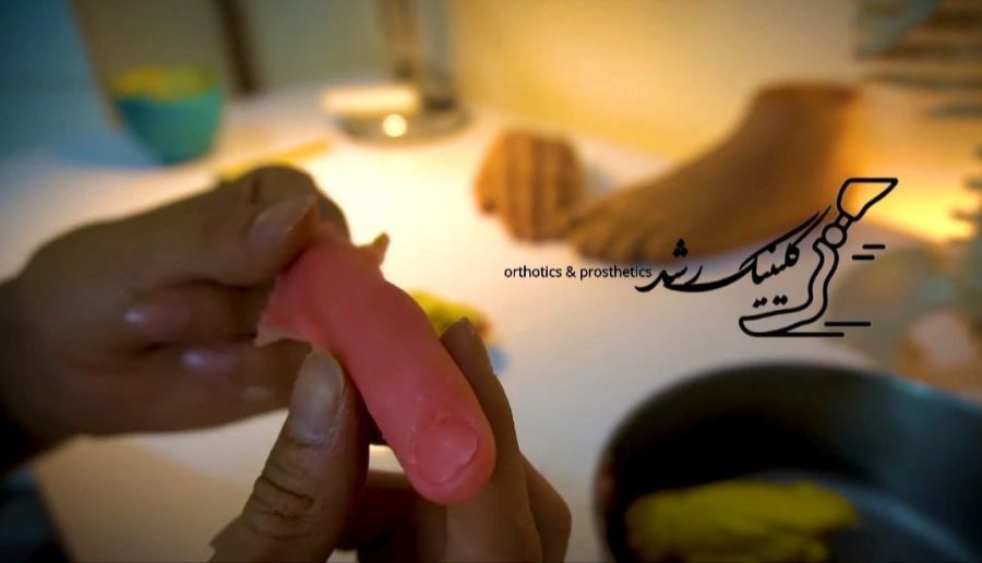 پرداخت و اصلاح جزئیات پروتز انگشت سیلیکونی در مرحله ساخت