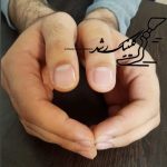 پروتز انگشت دست سیلیکونی با ظاهر کاملاً طبیعی