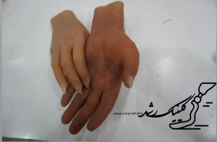 پروتز دست سیلیکونی زیبایی