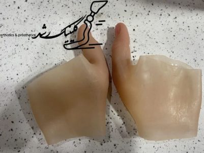 پروتز انگشت سیلیکونی دست‌ساز