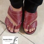 پروتز سفارشی انگشت شست پا با ظاهر طبیعی