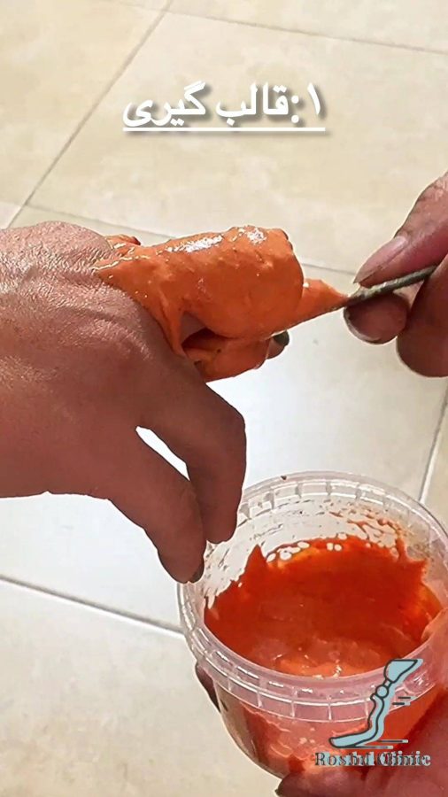قالبگیری برای ساخت پروتز انگشت میانی دست سیلیکونی