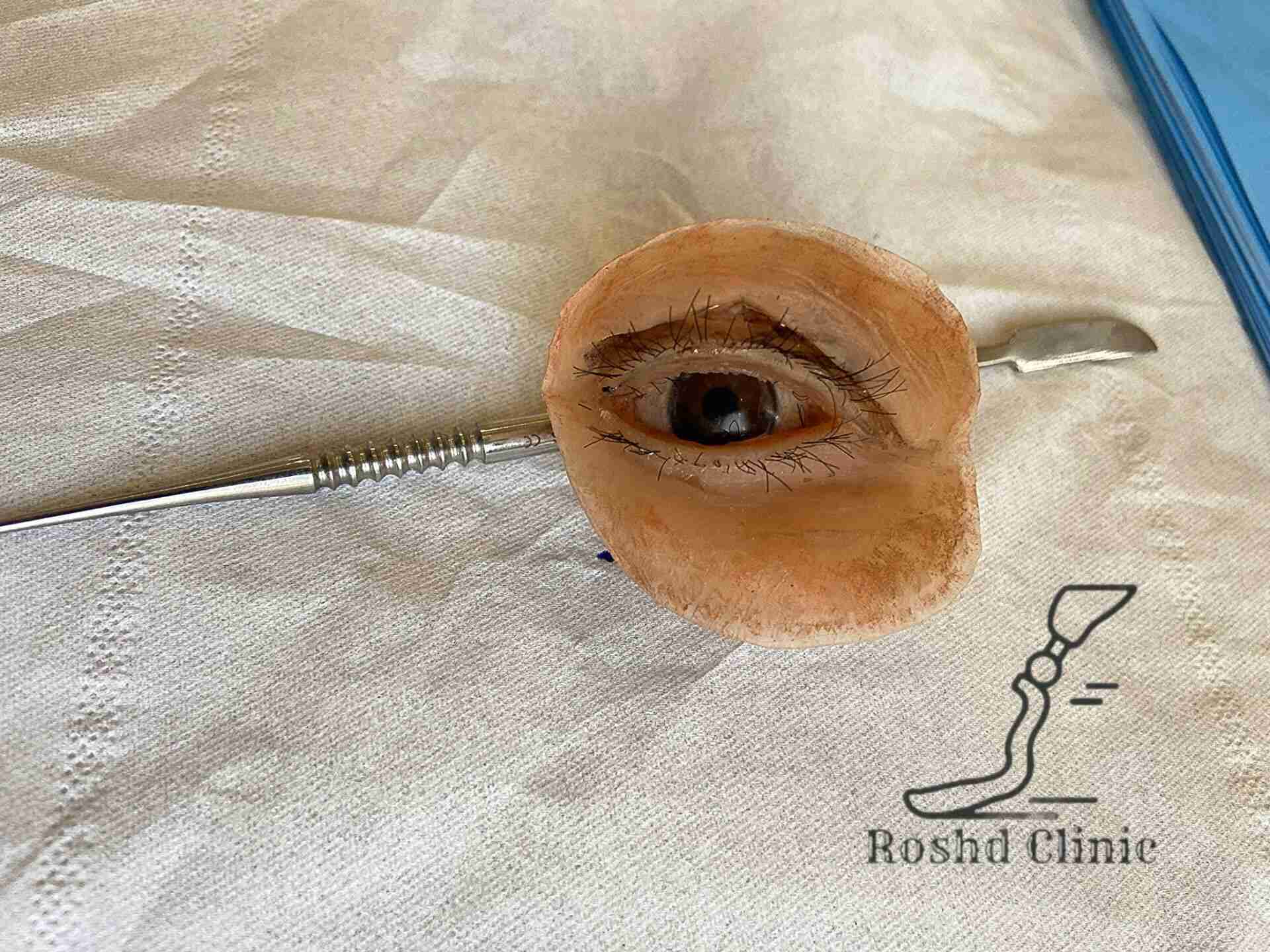 پروتز چشم سفارشی آماده