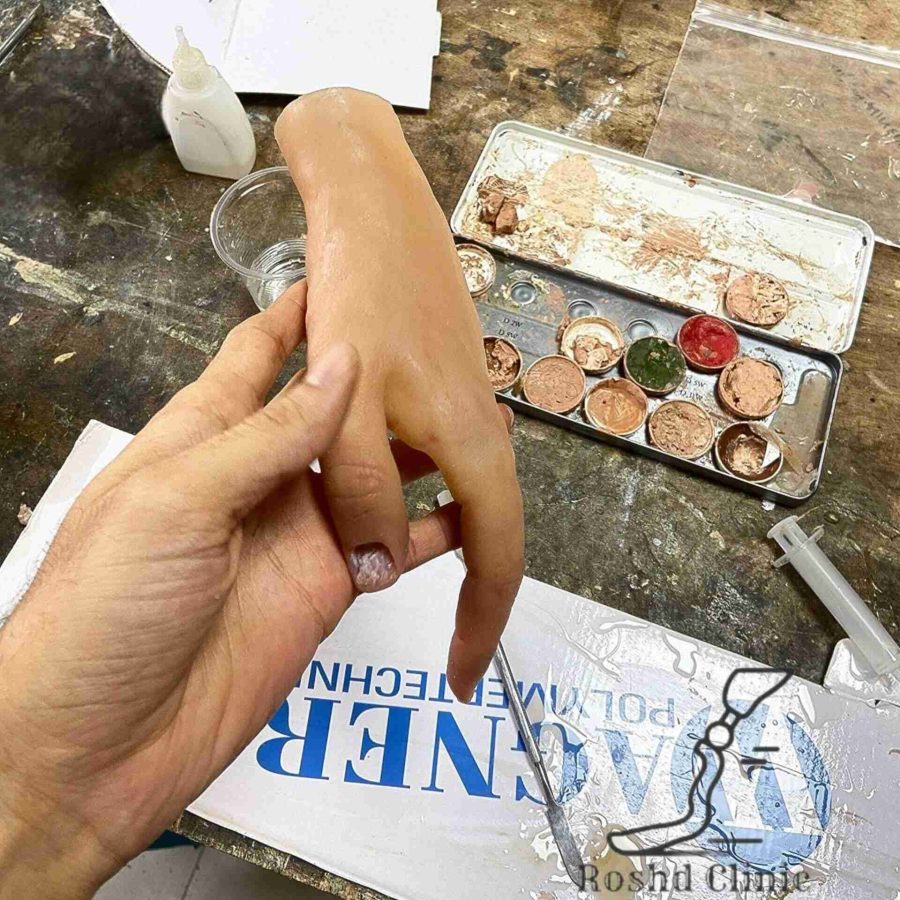 رنگ‌آمیزی پروتز انگشت دست