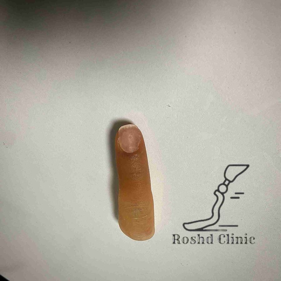پروتز انگشت دست سیلیکونی پیش از قرارگیری روی دست